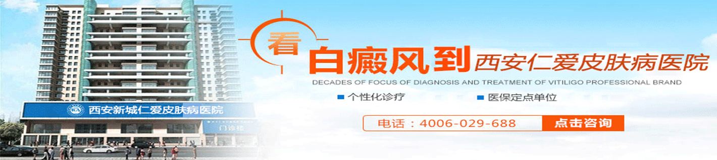 西安仁爱白癜风医�?/></a>
</div>
<div class=